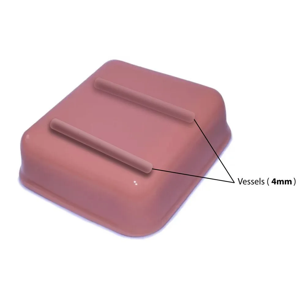HM2.0 -  Re-Moldable 2 Vessel Ultrasound Training Model
